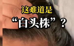 Télécharger la video: 女子“阳”后“一夜白头”且脱发严重 网友：“白头株”出现了？