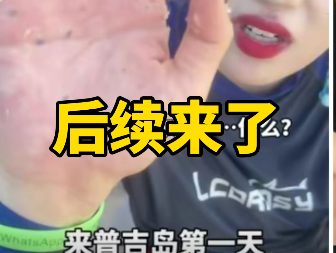 600万人看我被海胆扎手的后续来了