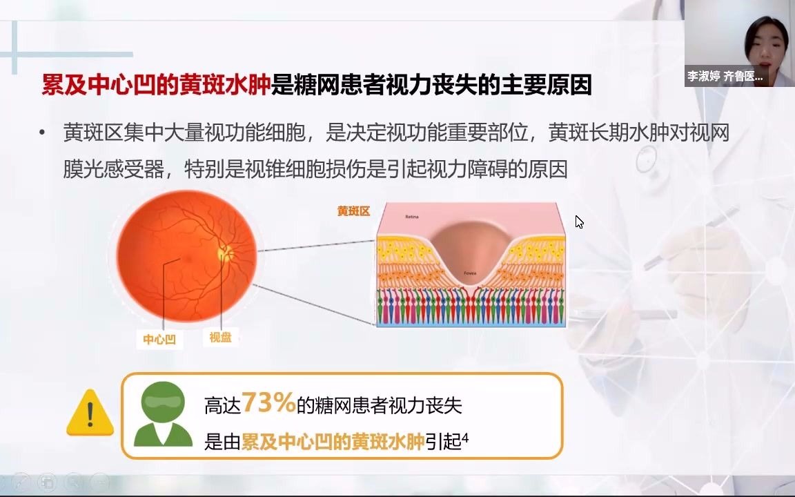 [图]DME的诊治