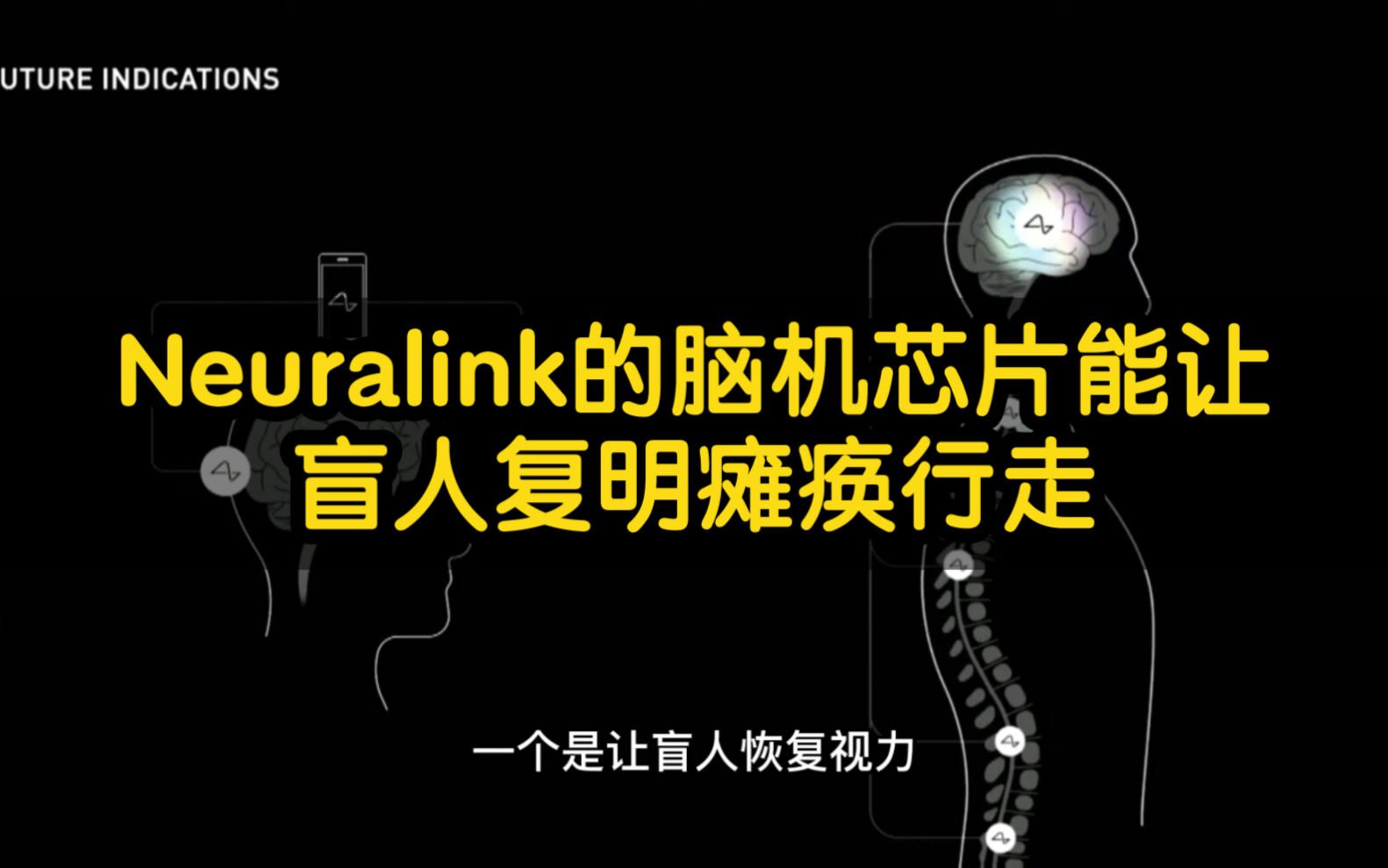 马斯克名下的脑机接口公司neuralink在近期的发布会上向外界公布了两项重大研究成果,一个是让盲人恢复视力,另一个是让瘫痪患者恢复行动能力哔哩哔...