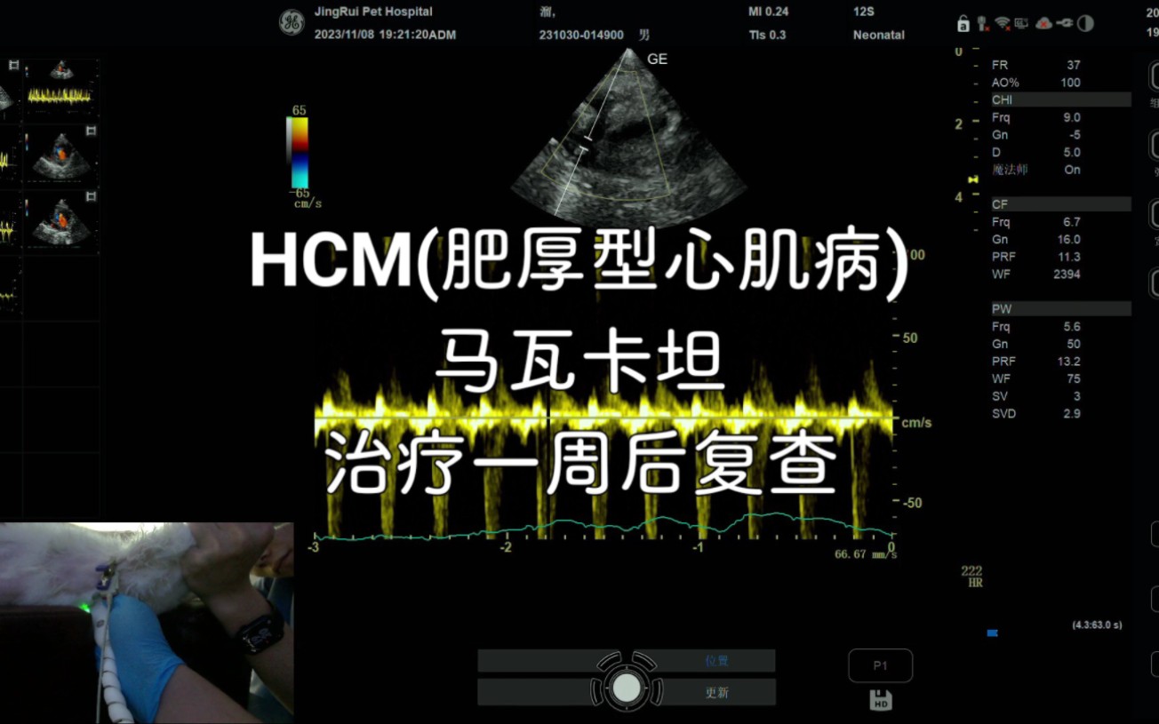 猫HCM(肥厚型心肌病)C期马瓦卡坦 治疗一周后复查感兴趣的朋友可以和之前发的视频对比看看,晚些会总结病程变化和治疗方案分享出来哔哩哔哩bilibili