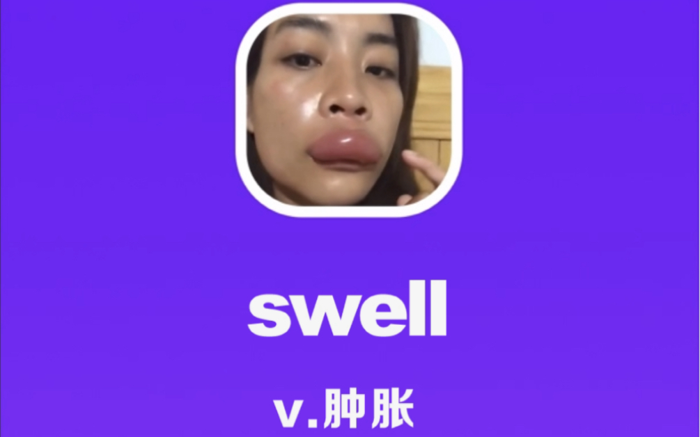 swell:肿胀哔哩哔哩bilibili