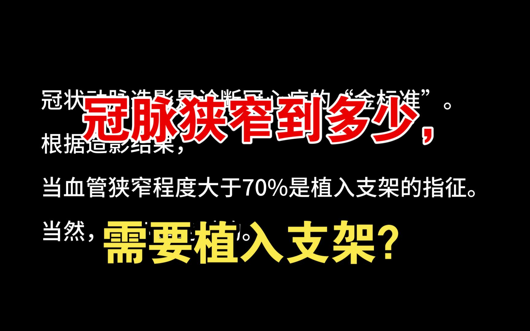 【心内科篇】冠脉狭窄到多少,需要植入支架?哔哩哔哩bilibili