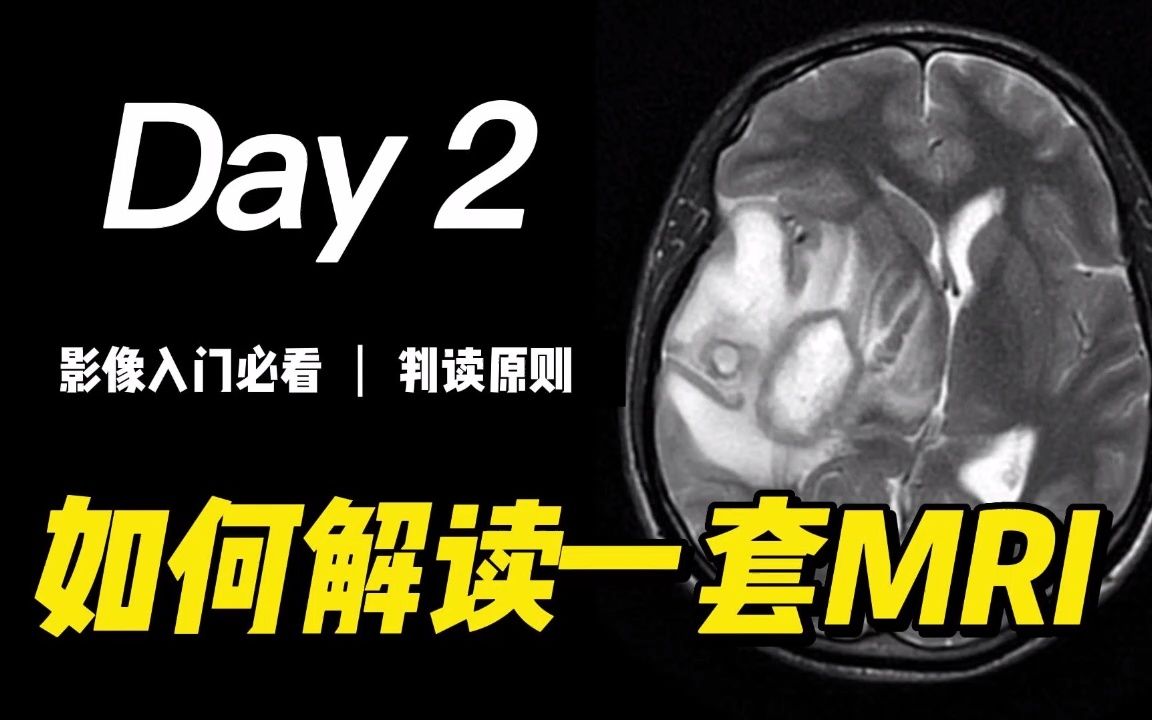 [图]如何解读一套MRI：判读原则 | 磁共振成像、医学影像、放射科、杨正汉