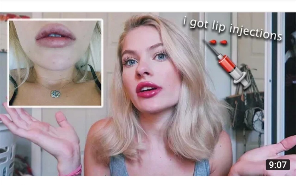 【Claudia Walsh】我为啥丰唇了 why i got lip fillers* vlog*哔哩哔哩bilibili