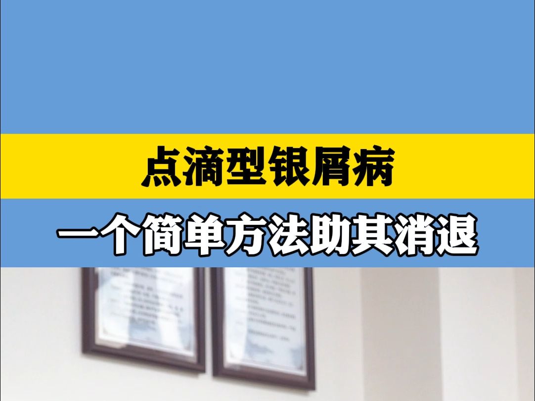 皮肤科娄卫海:点滴型银屑病,一个简单方法助其消退哔哩哔哩bilibili