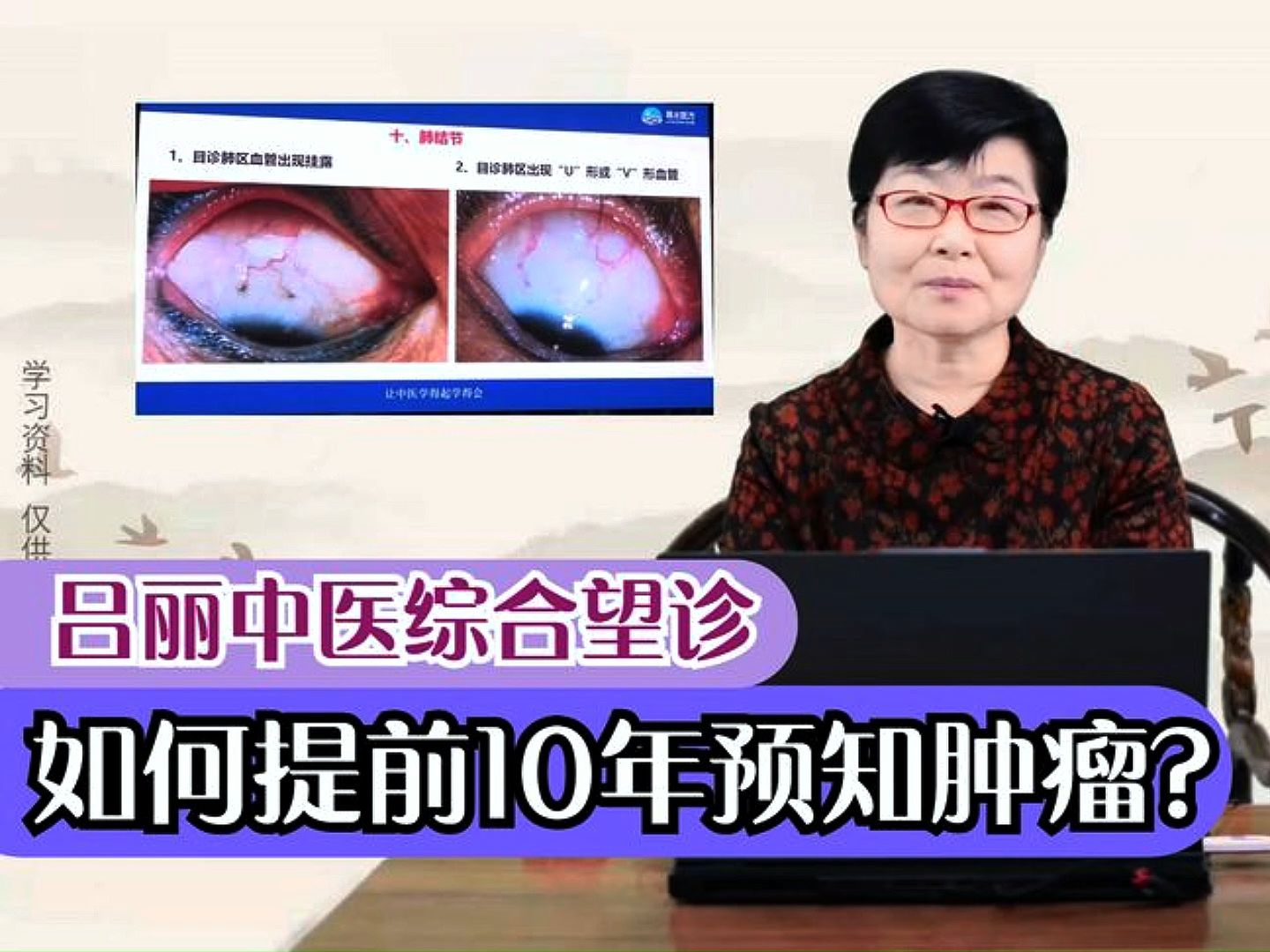 如何能提前10年发现肿瘤,其实脸上都摆着呢,只是你不知道!吕丽综合望诊!哔哩哔哩bilibili