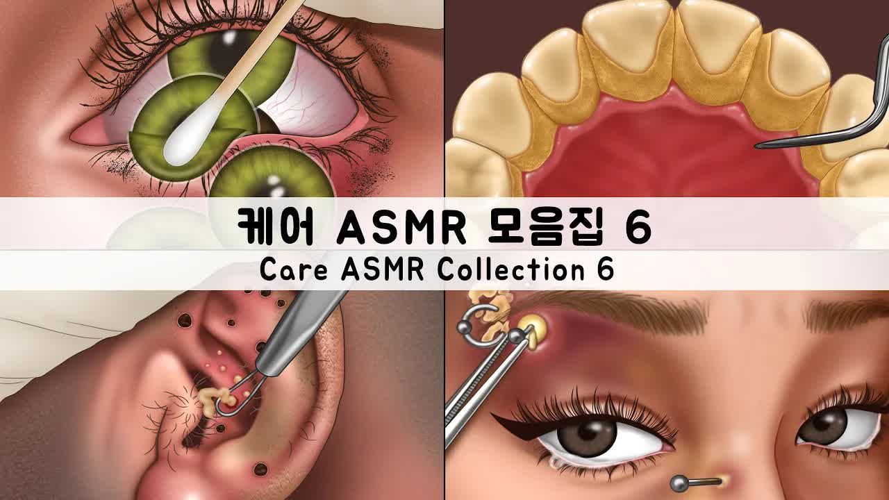 ASMR 解压清洁护理动画合集黑头、皮脂、麦粒肿、穿孔、牙垢哔哩哔哩bilibili