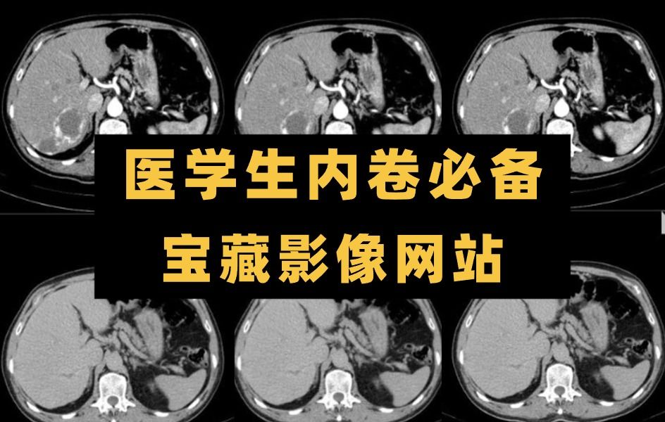 [图]医学生不能错过的宝藏影像网站，真的超级无敌好用！