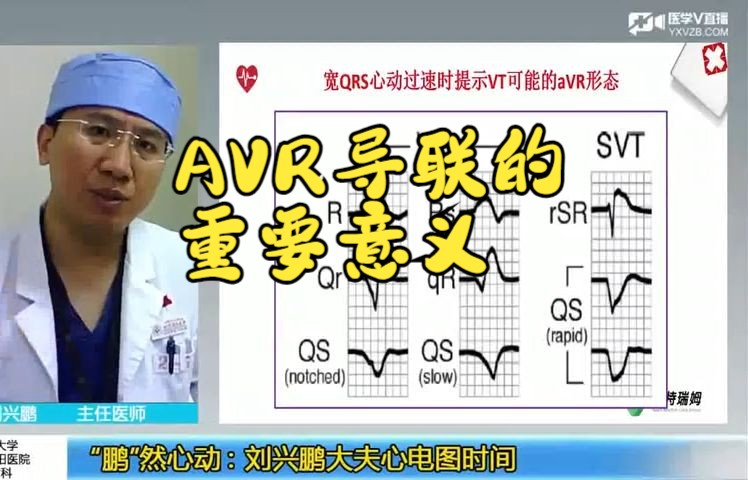 刘兴鹏心电图 AVR导联的重要意义哔哩哔哩bilibili