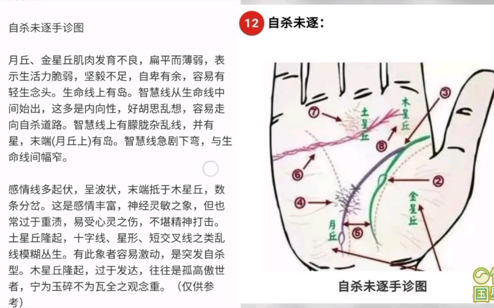 [图]手诊窍门：看手就知十几种病，包括看出人是否自S