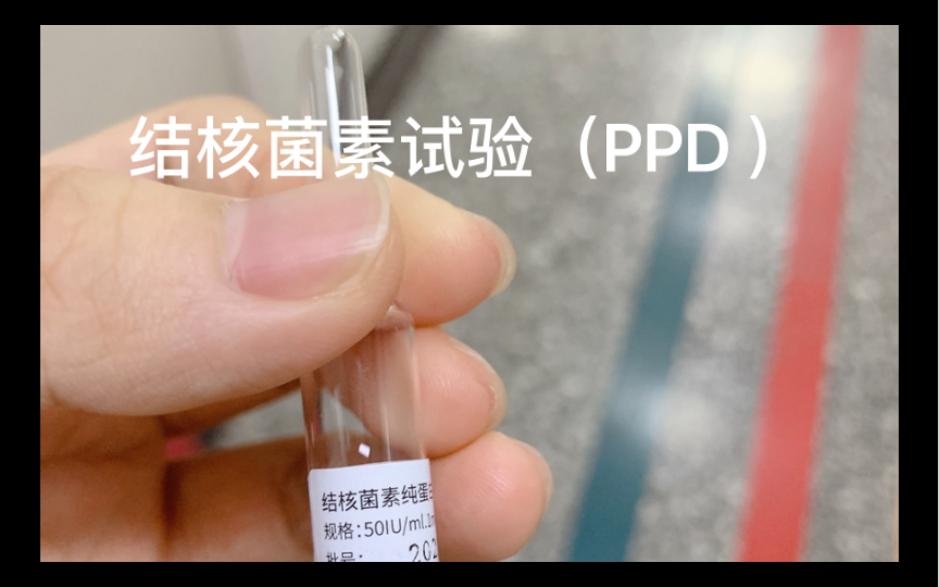 PPD (结核菌素试验)步骤哔哩哔哩bilibili