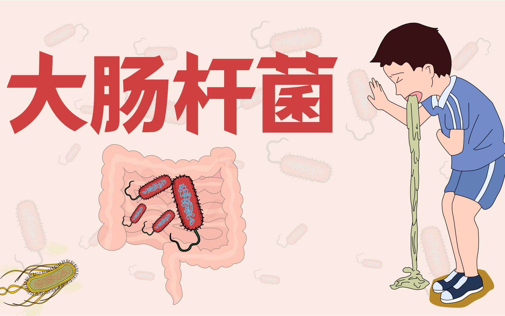 大肠杆菌的症状是什么(大肠杆菌感染会出现哪些症状)