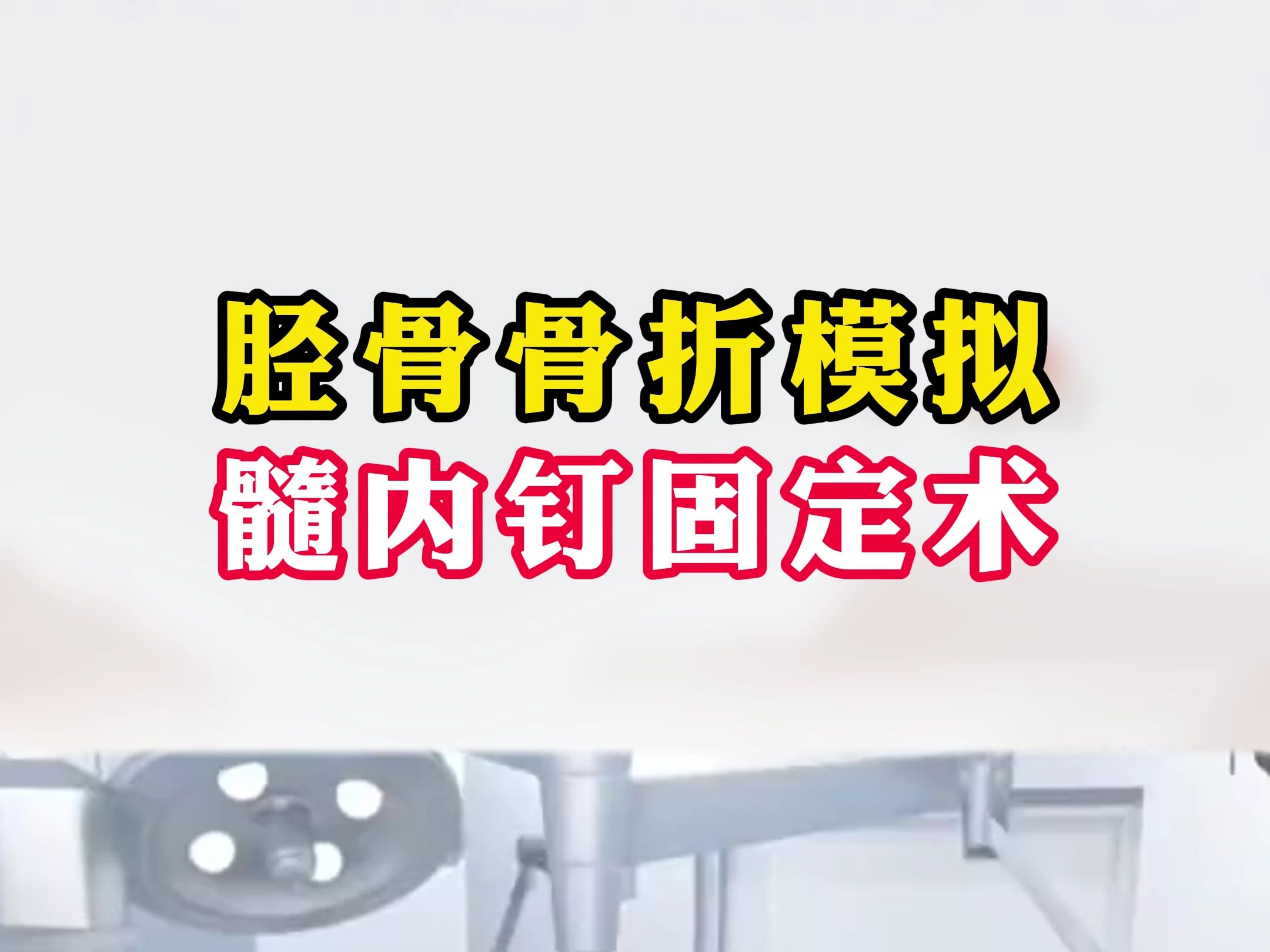 胫骨骨折模拟髓内钉固定术