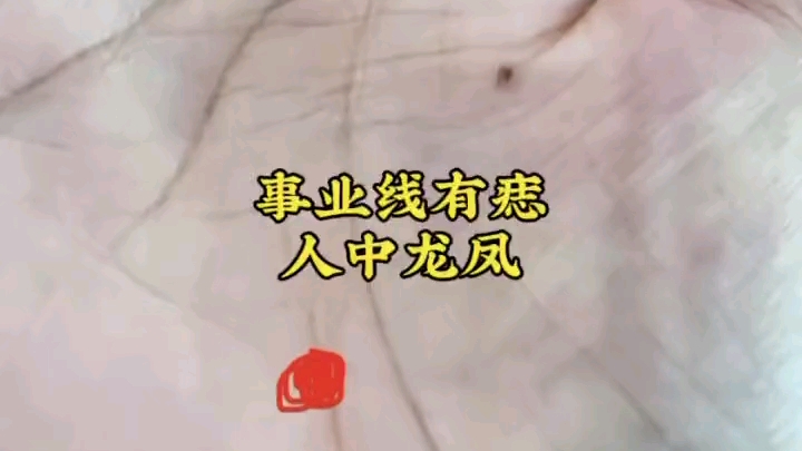 事业线有痣,人中龙凤