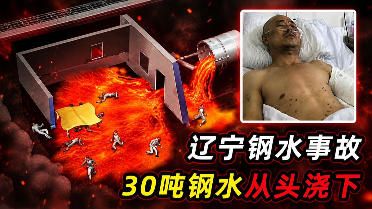 人掉进钢水会怎样？1500度钢水从头浇下，32名工人遇难
