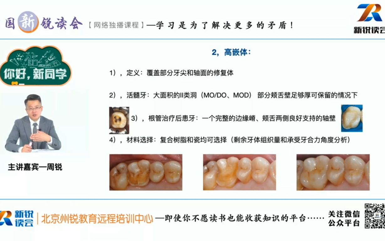 [图]第一节-嵌体设计与制备粘接 周锐老师（共9节课）