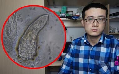 显微镜放大黑头 螨虫2000倍,放大2000倍的螨虫就像外星生物