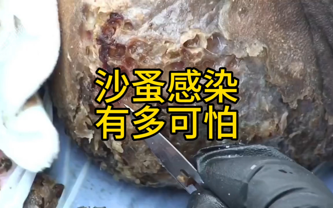 警惕!沙蚤感染引发的恐怖后果!