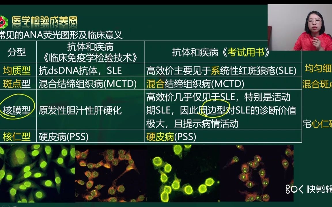 [图]系统性红斑狼疮【一个知识点弄透，无论题怎么变，你都会做】——医学检验讲师（成美恩）