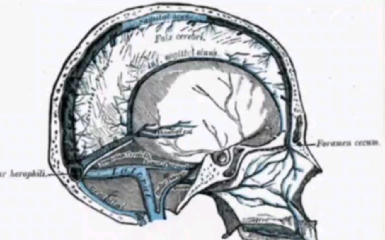 影像脑静脉窦解剖简单讲解.哔哩哔哩bilibili