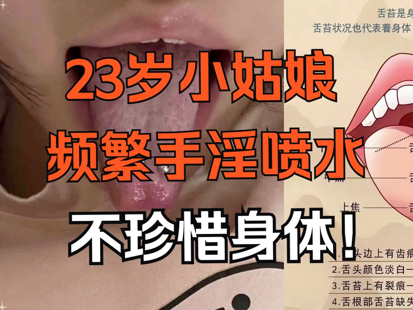 【舌诊案例】23岁叛逆小姑娘,带舌钉频繁手淫,使劲糟蹋身体!!哔哩哔哩bilibili