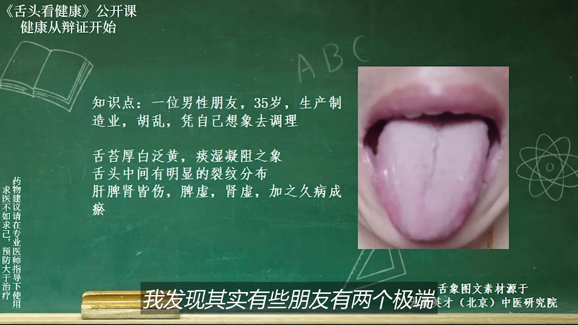 舌象分析:饭后胃胀想吐,心悸,痰湿气滞有血瘀的舌象讲解哔哩哔哩bilibili