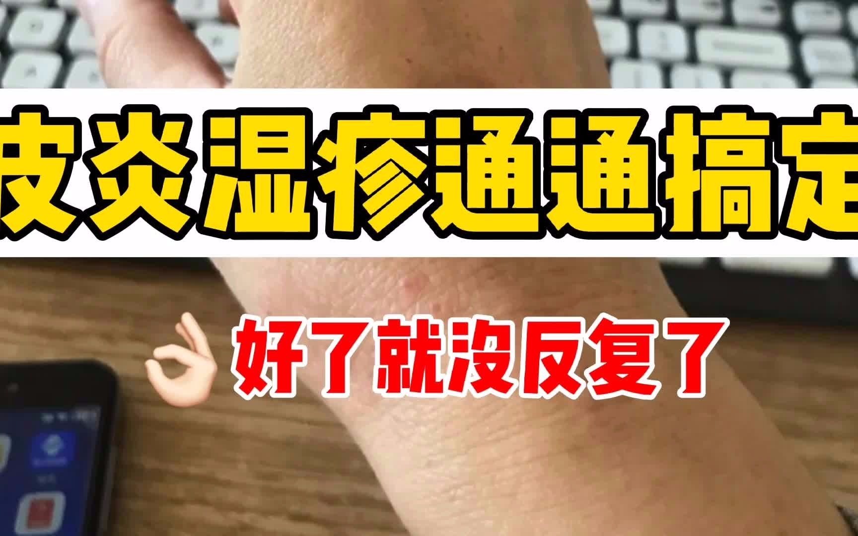 皮炎湿疹通通搞定!再也不怕它反复啦!哔哩哔哩bilibili