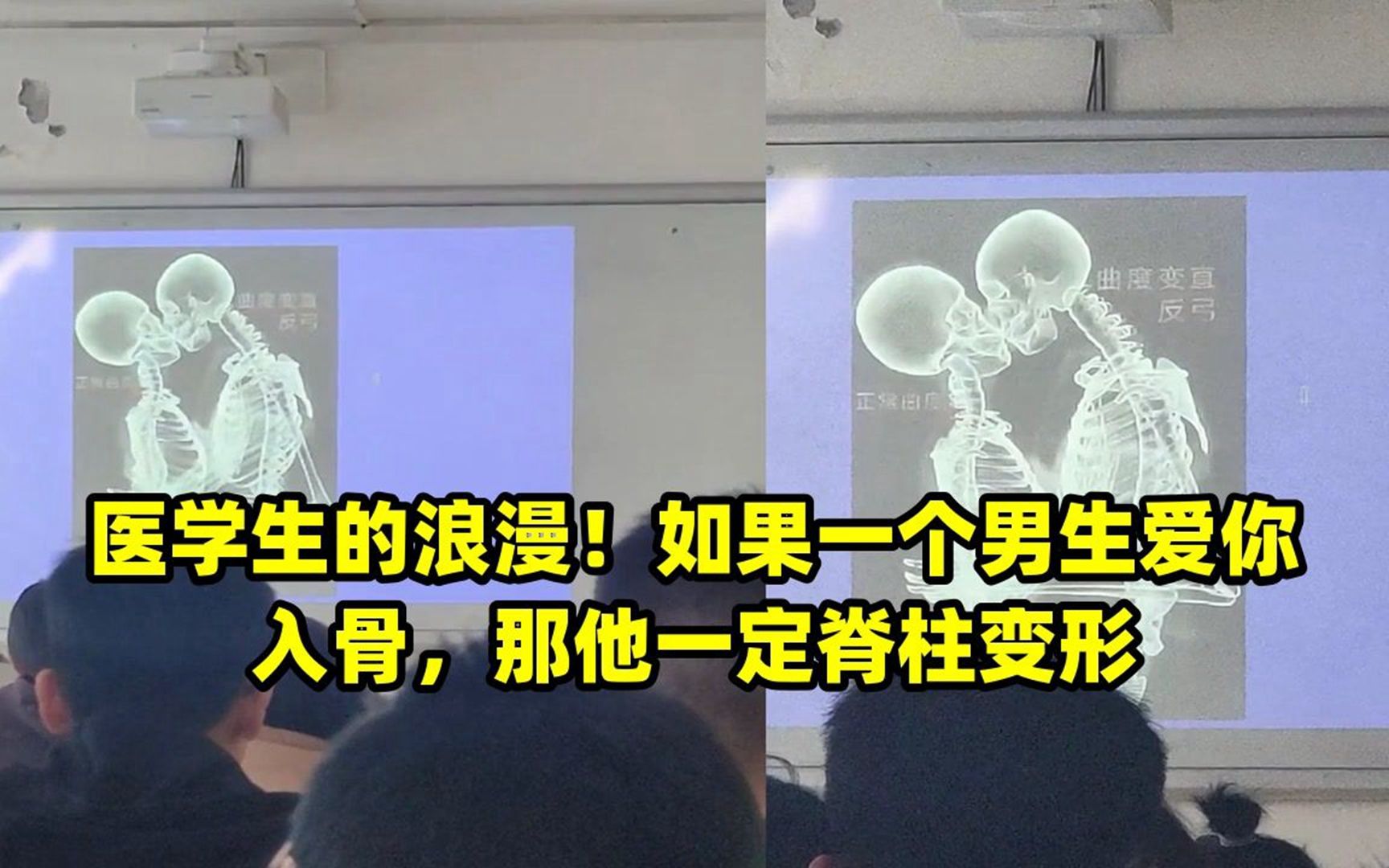 醫學生的浪漫!如果一個男生愛你入骨,那他一定脊柱變形