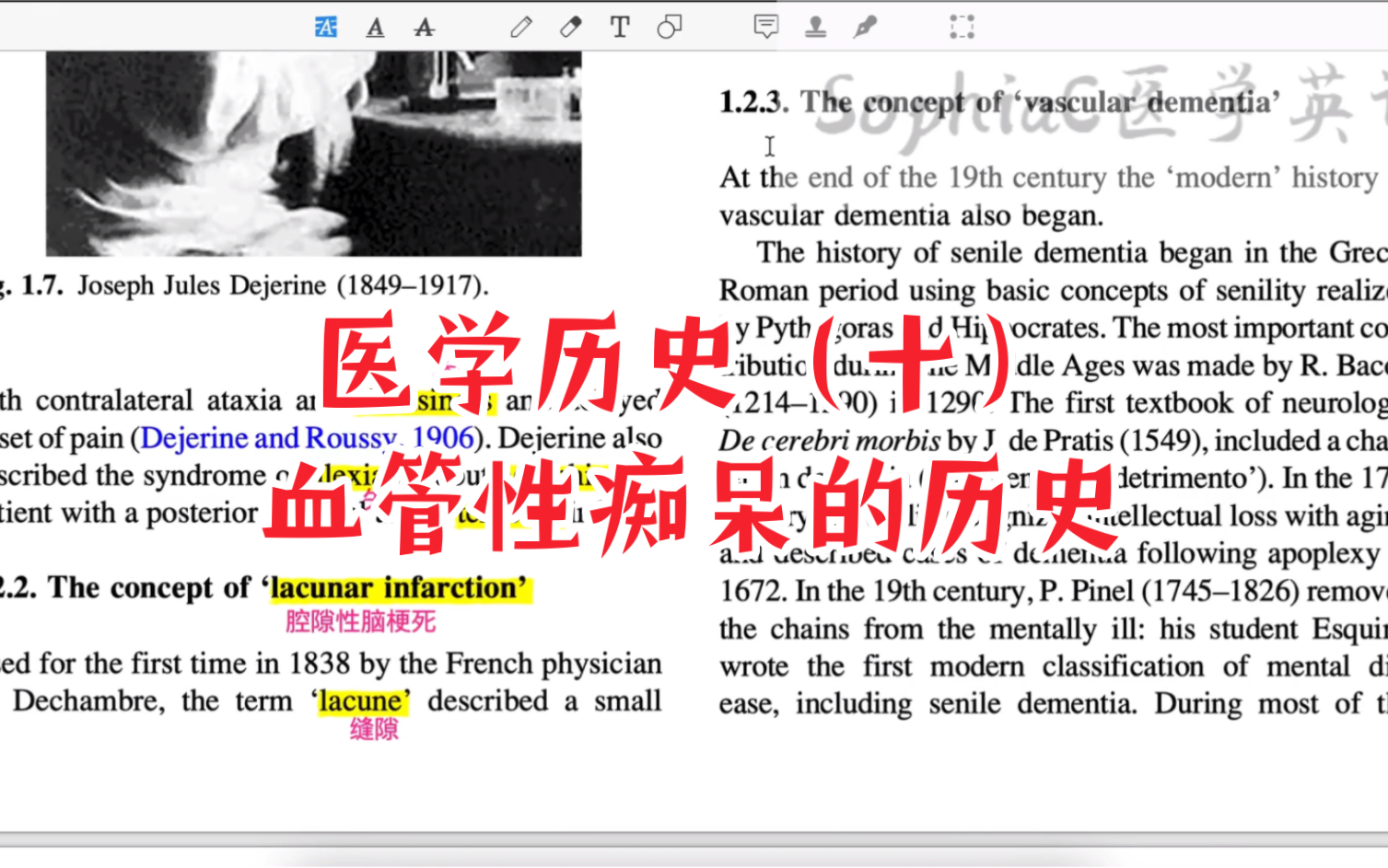 医学历史(十)血管性痴呆的历史.医学生、神经科医生可以了解一下.哔哩哔哩bilibili