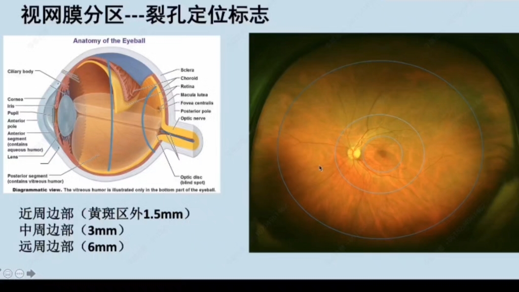 一语醍醐之视网膜分区哔哩哔哩bilibili