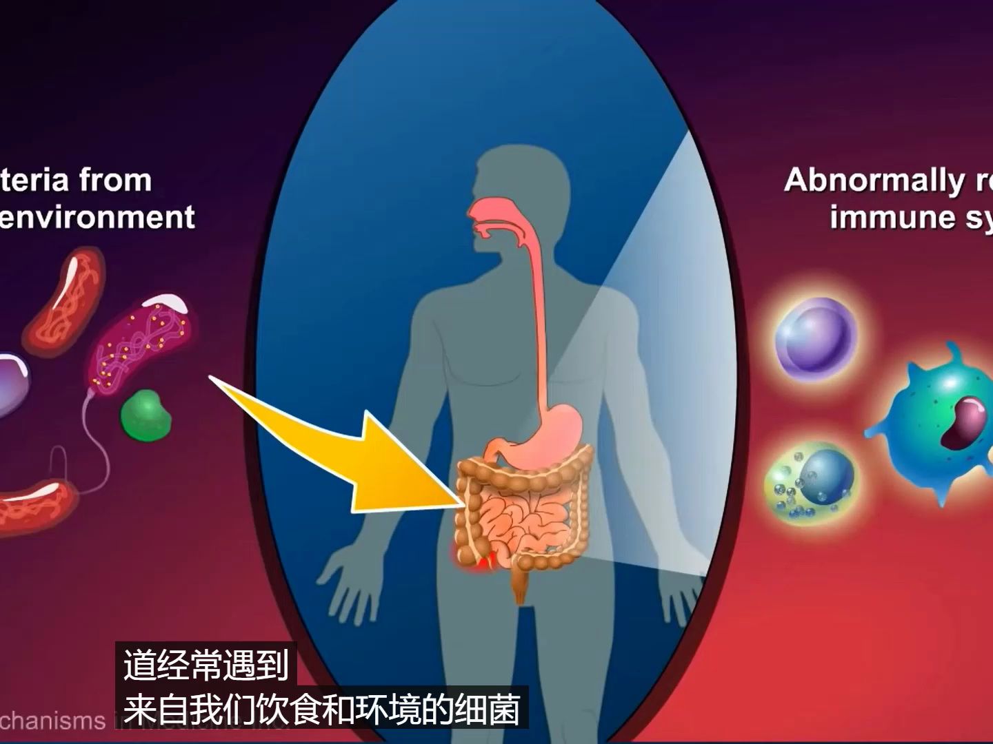 什么是克罗恩病(Crohn's disease)?油管百万播放量哔哩哔哩bilibili