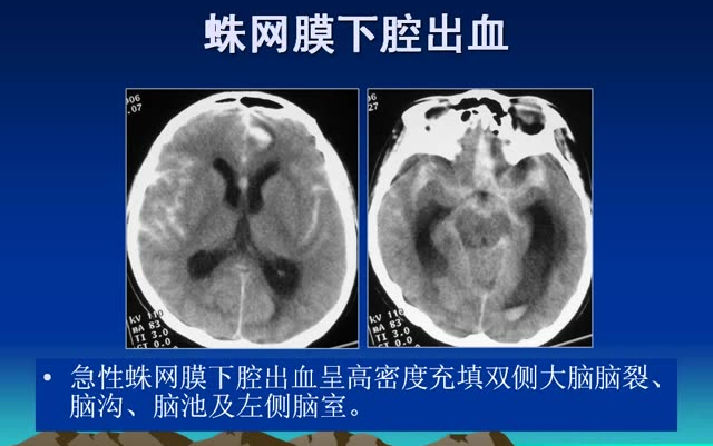 超齐全CT培训视频,带你由浅入深学习CT技巧!哔哩哔哩bilibili