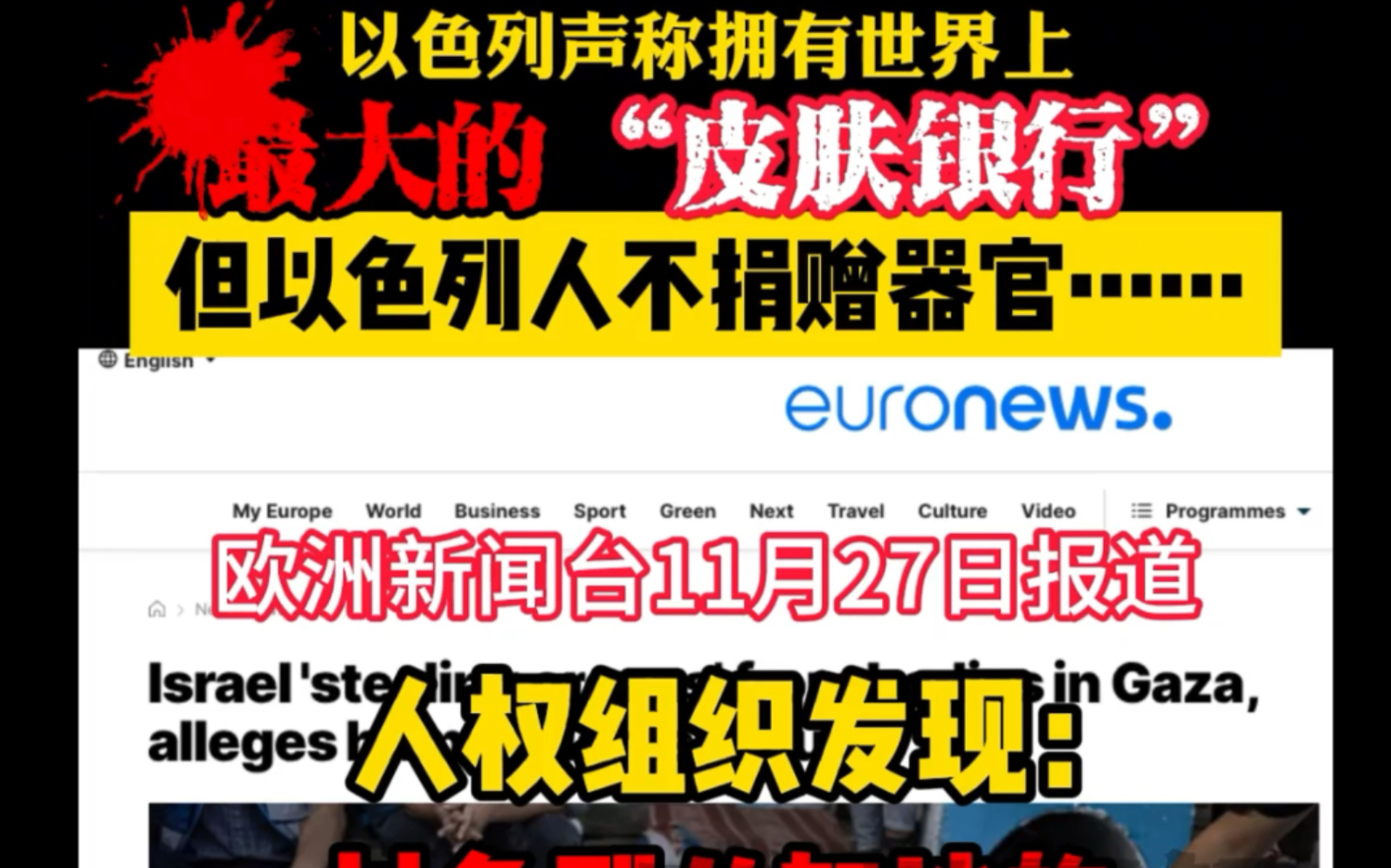 以色列拥有全球最大的“皮肤银行”,以色列人:我们从来不捐……哔哩哔哩bilibili