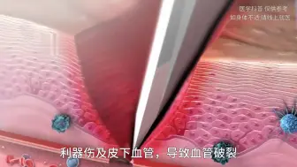 Download Video: 伤口是怎么自动愈合的？原来身体悄悄为你付出了这么多