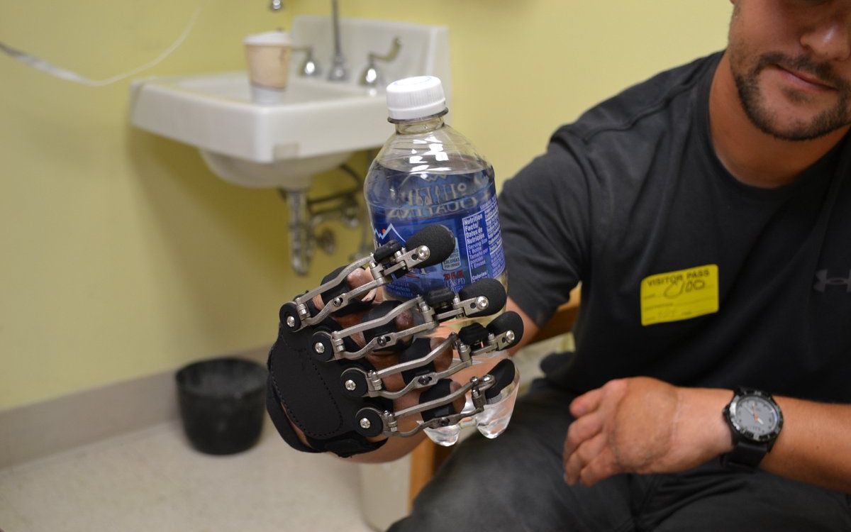 国外研发一款机械手指, 专为残障人士设计, 用起来跟原装一样灵活