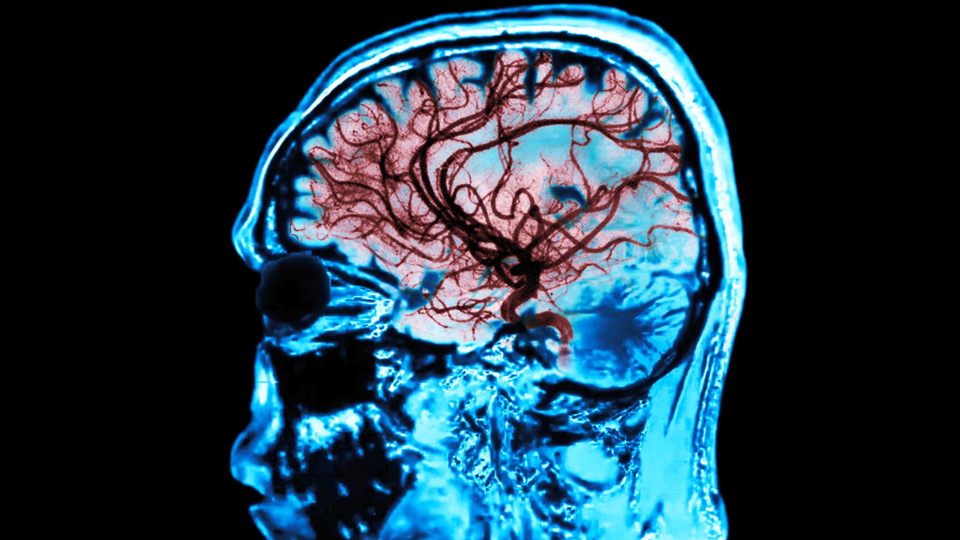 一个家庭食用了可疑的午餐，这是他们的器官发生的变化