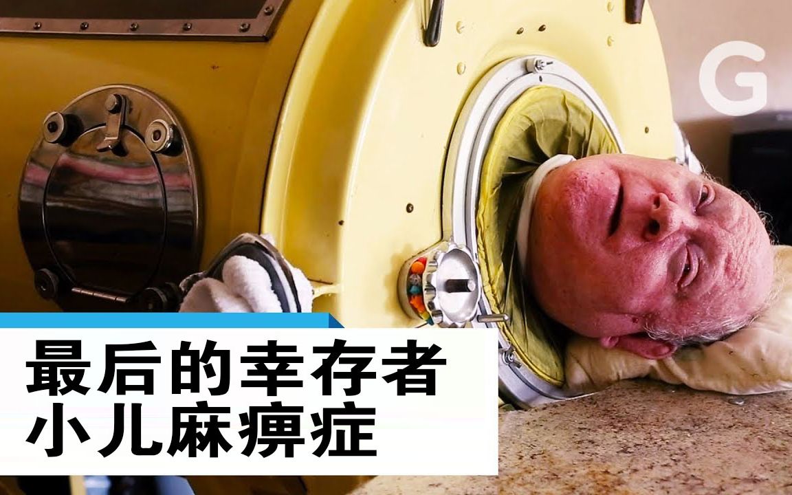 最后的小儿麻痹症幸存者 - 最后的铁肺 @柚子木字幕组