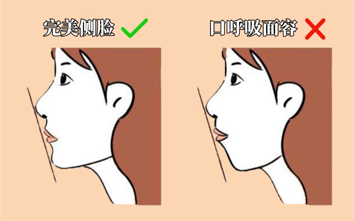 【改善突嘴   下巴后缩】长时间口呼吸让你的颜值直线下降?