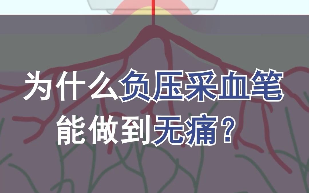 什么是负压采血笔?哔哩哔哩bilibili