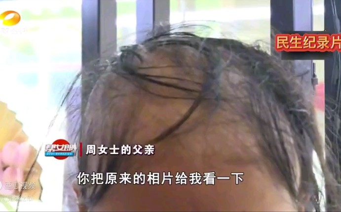 长沙女子养发店洗发1次变“秃顶”:护前长发飘飘,护后变成秃瓢哔哩哔哩bilibili