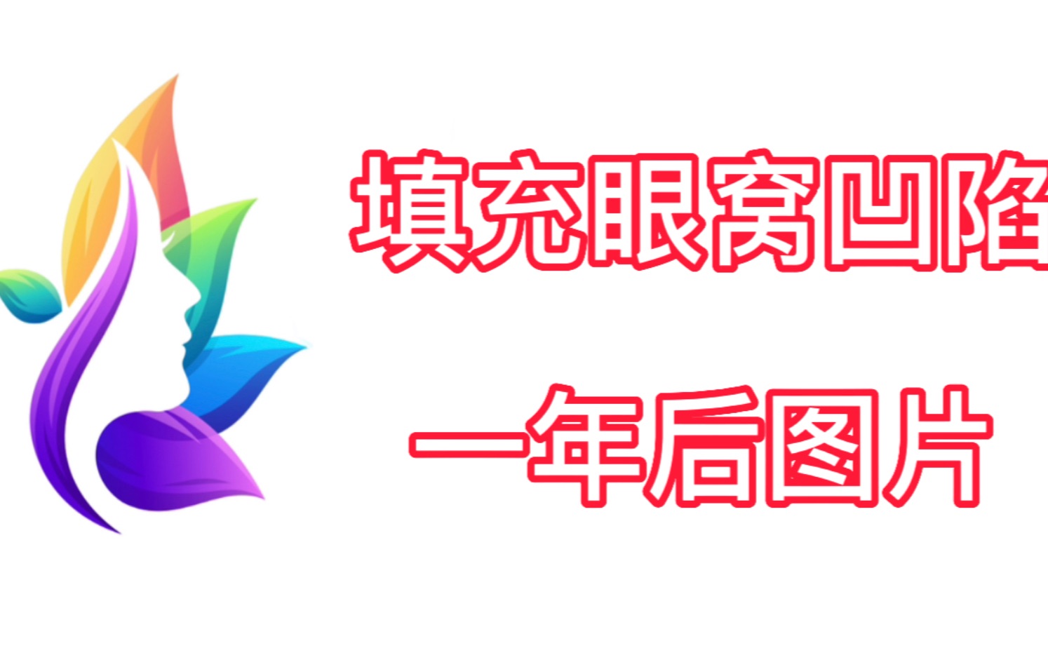 脂肪填充眼窝凹陷图片真人展示:脂肪填充眼窝一年后图片效果真的绝绝子!哔哩哔哩bilibili