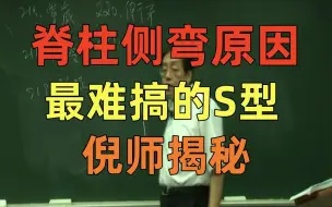 Download Video: 倪海厦 脊柱侧弯原因 S型 C型 实在想不到 非常重要的内容