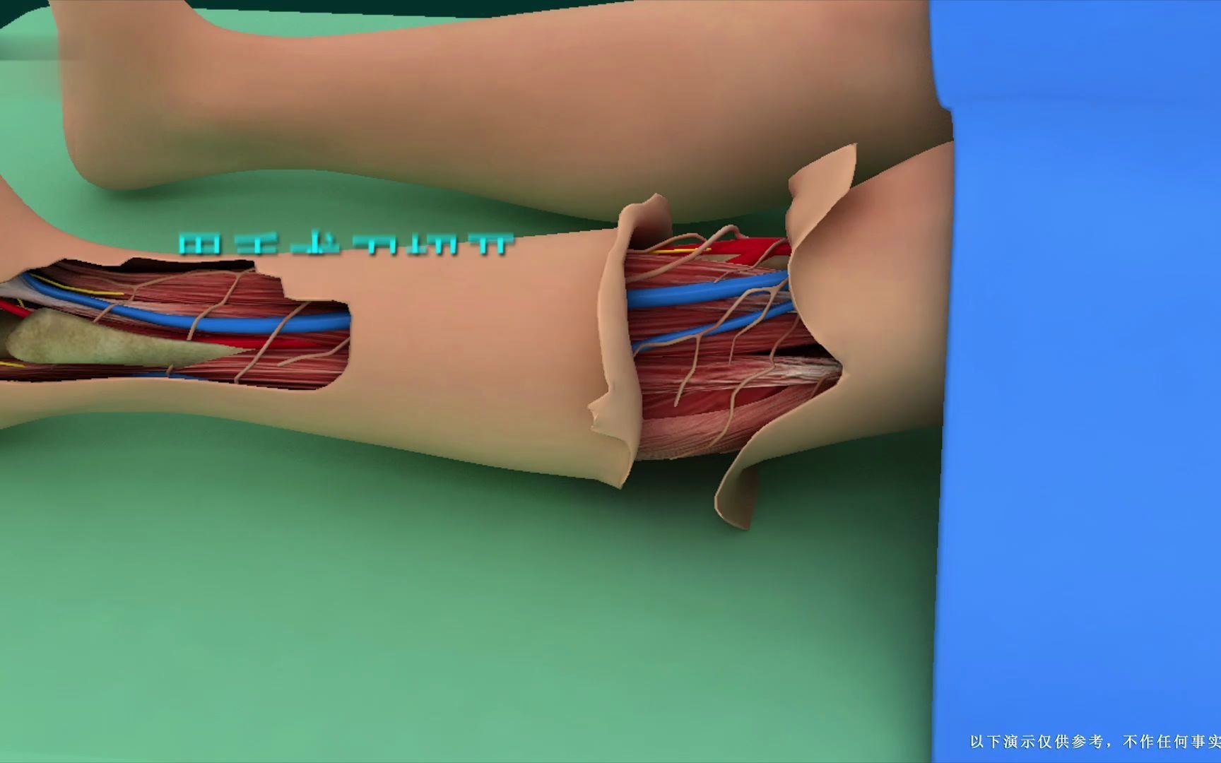 [图]医学视频：截肢手术演示，一定要好好爱惜自己的身体！