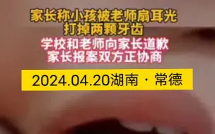 Tải video: 2024.04.20湖南常德。一学生被老师扇耳光打掉两颗牙 ，学校和老师道歉 ！家长提出10万赔偿，并已报案！目前双方正协商解决。