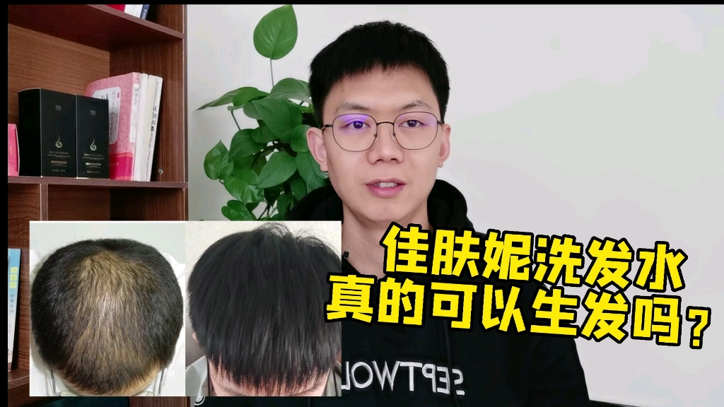 佳肤妮洗发水真的可以生发吗,佳肤妮防脱洗发水有效果吗?哔哩哔哩bilibili