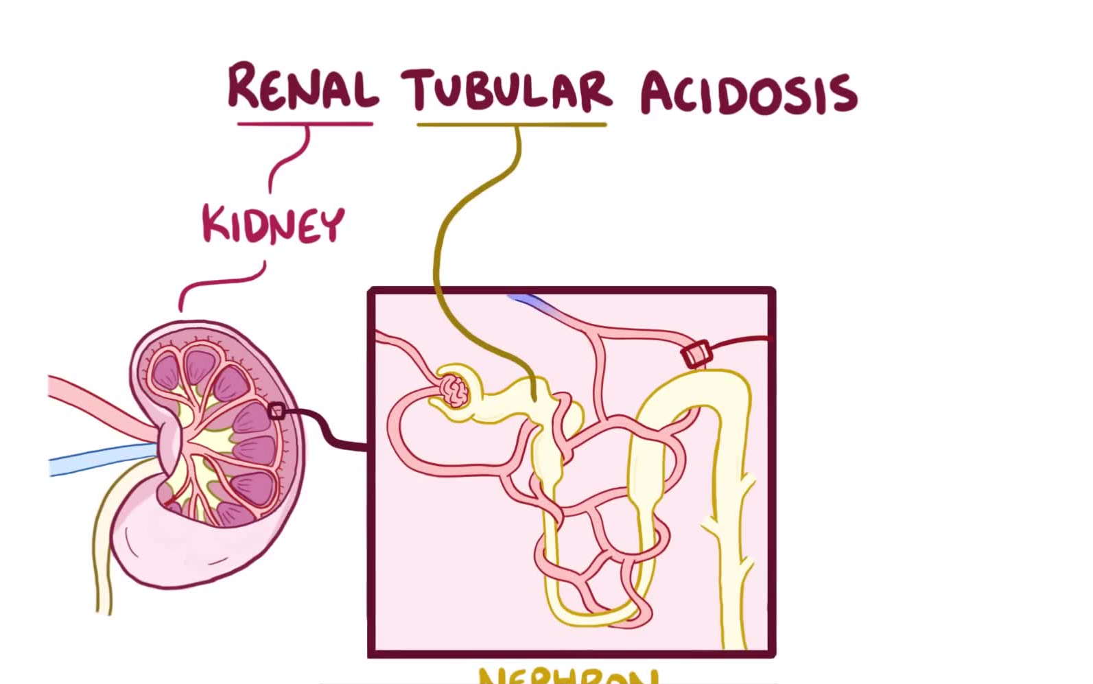 医学公开课:肾小管性酸中毒【osmosis搬运 中英字幕】