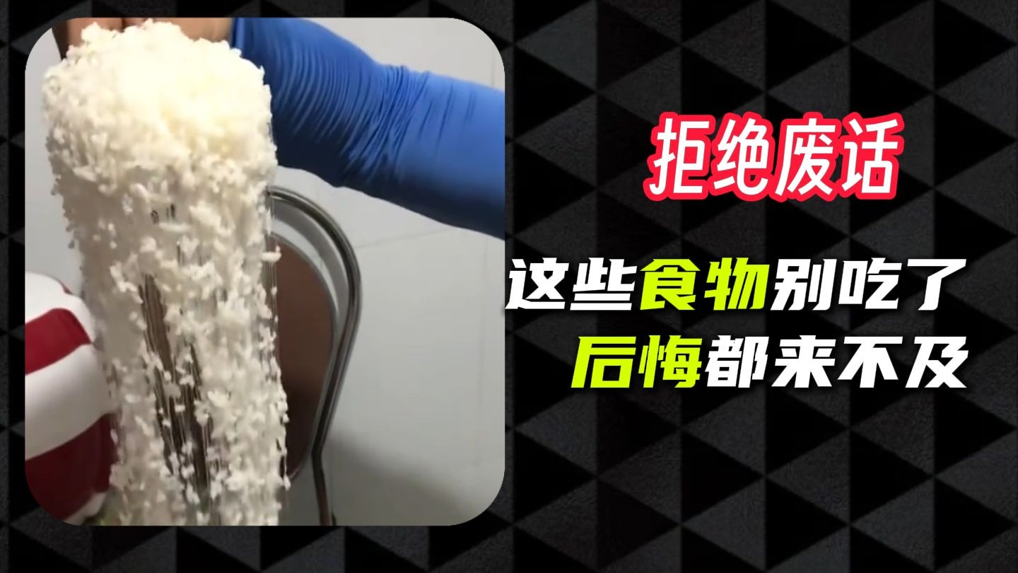 这些不能吃的食物里有你朋友的最爱吗？